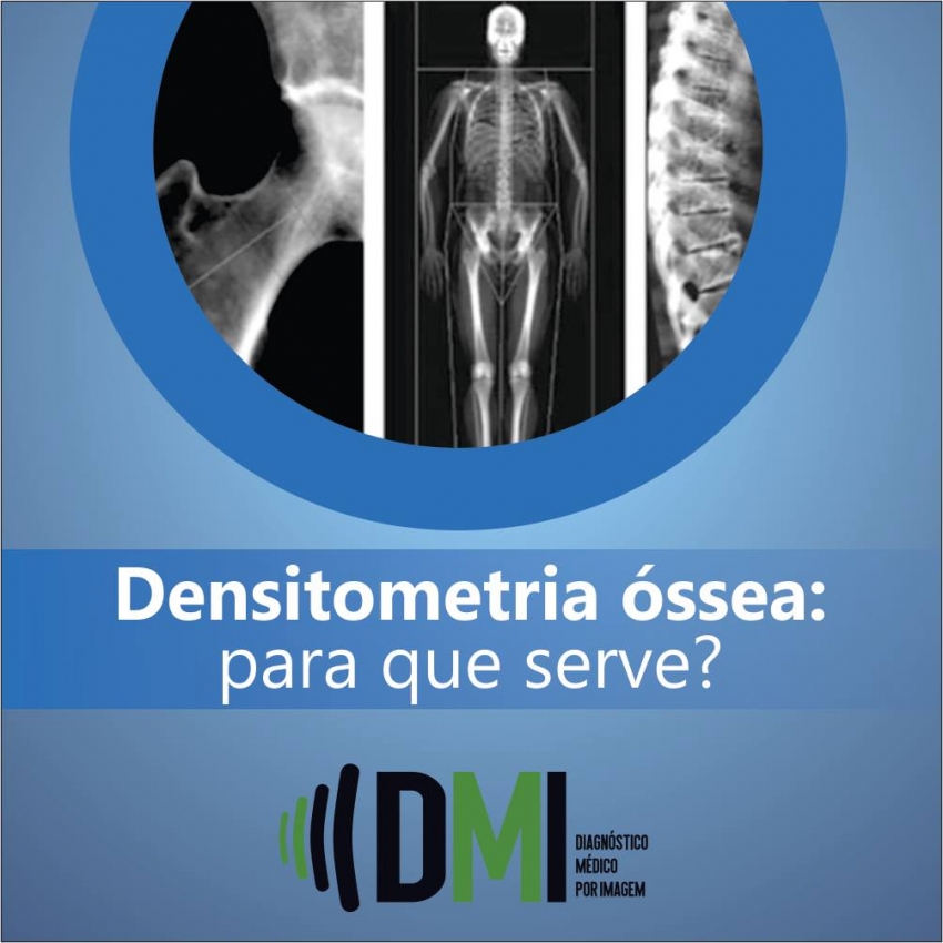 Densitometria ssea para que serve dmi diagn stico m dico por imagem